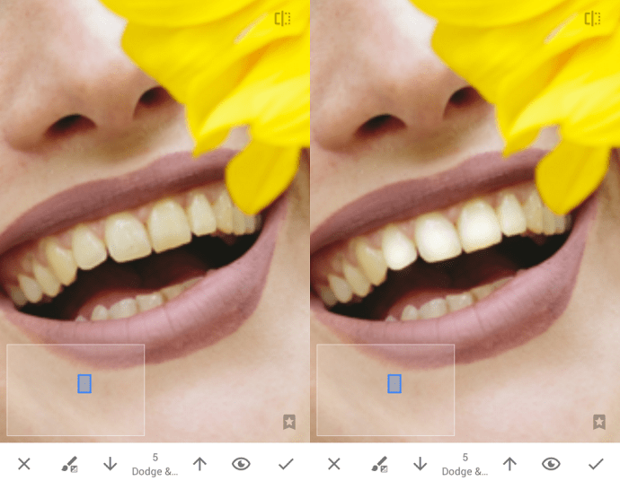 Balinkite dantis su Snapseed